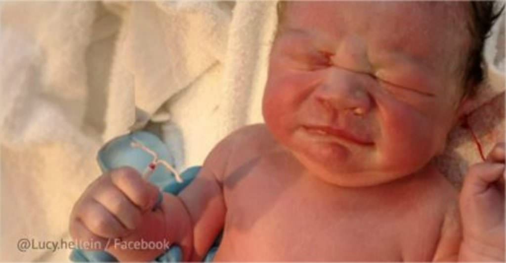 Ella Quedó Embarazada A Pesar De Tener La T De Cobre Su Bebé Nació Con Una Gran Sorpresa Veobook 4875